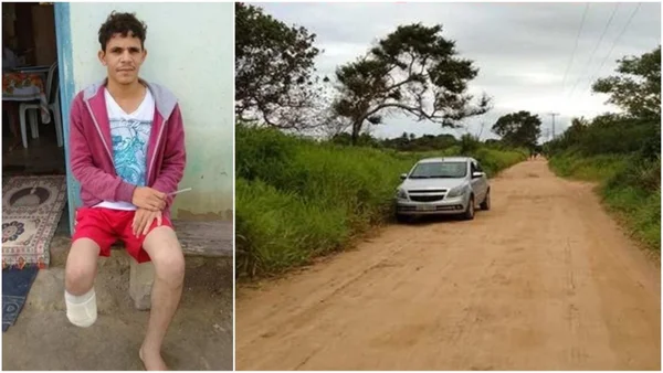 homem com perna amputada