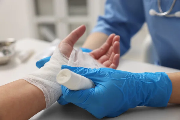 Imagem mostra médico com luvas colocando um curativo na mão de uma pessoa com queimadura - Metrópoles