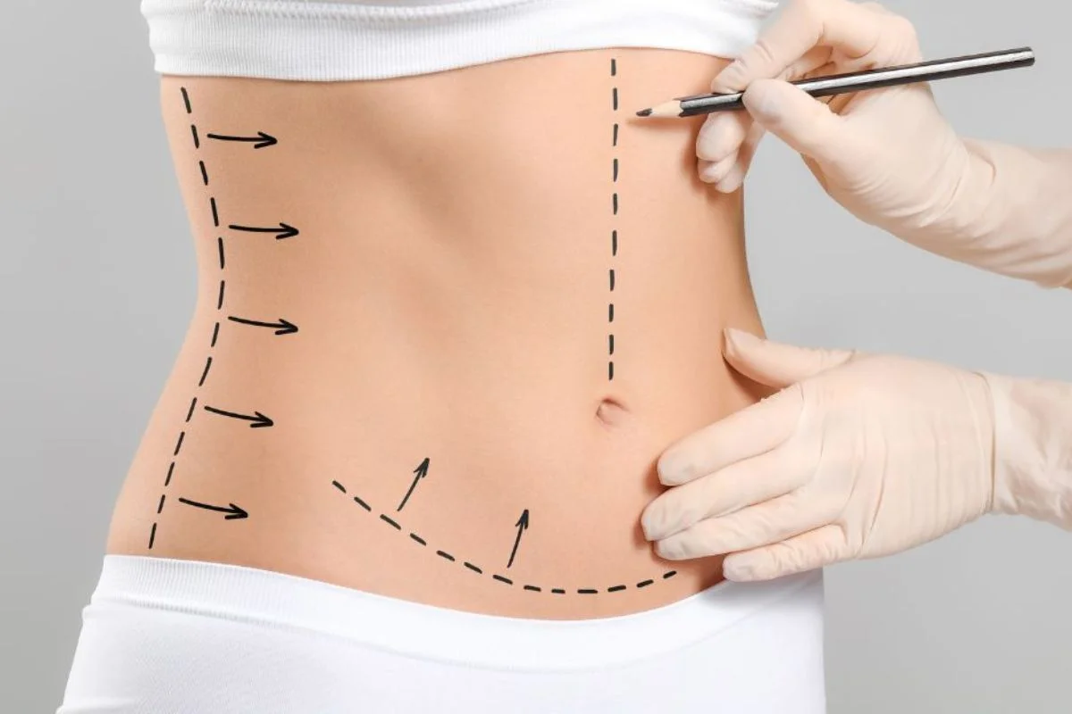 Segurança na cirurgia plástica depende de 7 cuidados fundamentais - imagem 5 Segurança na cirurgia plástica depende de 7 cuidados fundamentais - imagem 5