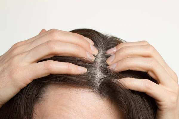 Foto colorida de mulher com os dedos na raiz do cabelo - Metrópoles