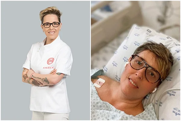 Ex-MasterChef é internada na UTI com problema neurológico