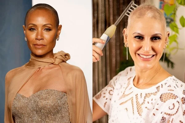 Jada Smith ao lado da esteticista Keyla Andreoli: as duas vivem com alopécia