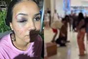 Letícia Oliveira, de 22 anos, foi agredida em shopping do Rio Letícia Oliveira, de 22 anos, foi agredida em shopping do Rio