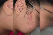 A profissional de saúde foi atacada por uma paciente A profissional de saúde foi atacada por uma paciente