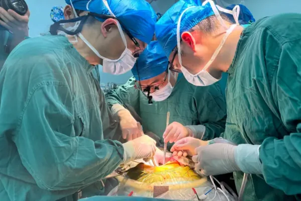 Cirurgiões realizando transplante de fígado de porco no Primeiro Hospital Afiliado da Universidade Médica de Anhui, China, em maio de 2024