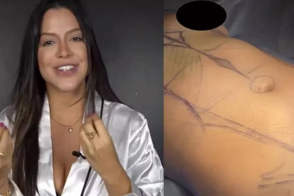 Saiba quanto custa a lipo LAD realizada pela ex-BBB Lais Caldas