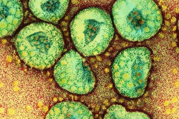 Coronavírus: Anvisa aumenta atenção em portos e aeroportos