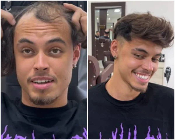 Montagem colorida com foto de influencer calvo - Metrópoles