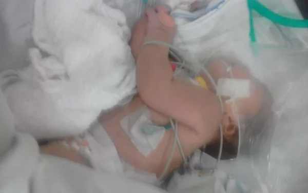 Bebê é picada seguidas vezes por escorpião preso ao cordão umbilical