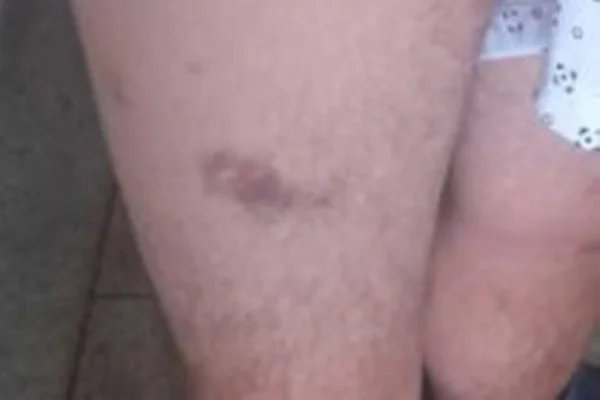 clínica de reabilitação é interditada em goiás, após denúncia de tortura