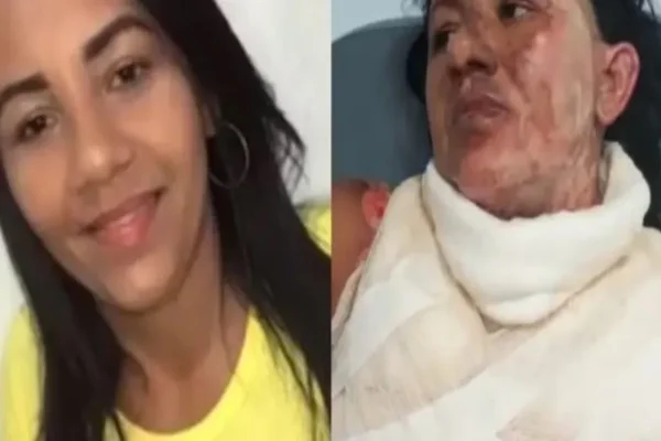 Imagem colorida de mulher quiemada 0 Metrópoles