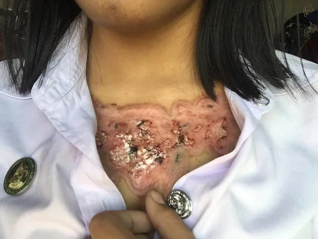 Garota relata momentos de dor ao remover tatuagem com método polêmico - imagem 10 Garota relata momentos de dor ao remover tatuagem com método polêmico - imagem 10