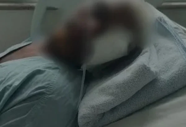 Alta hospitalar de autista espancado é adiada duas vezes após desmaios