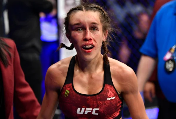 Joanna Jedrzejczyk com rosto inchado