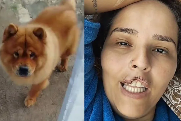 Cachorro arranca lábio de tutora e é submetido a eutanásia - Metrópoles