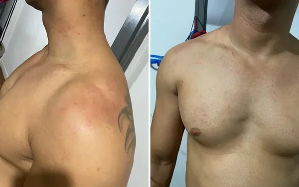 imagem colorida fã agredido show gusttavo lima
