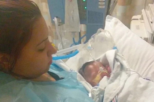Bebê que nasceu sem pele recebe órgão criado em laboratório