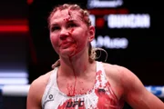 Daria Zhelezniakova ficou com corte profundo na testa após cotovelada da brasileira. Daria Zhelezniakova ficou com corte profundo na testa após cotovelada da brasileira.