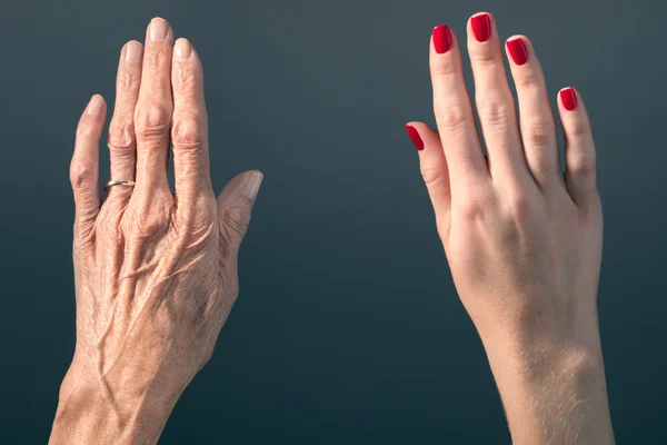 Busca por rejuvenescimento das mãos aumenta, mas exige cautela