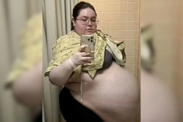 Imagem de Alisson mostrando o tumor - Metrópoles