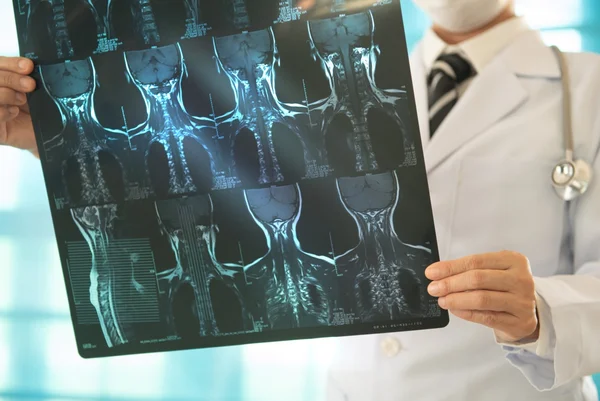 Cirurgiões ortopédicos ou médicos cirurgiões ortopédicos verificam imagens de raios-X de espondilose cervical para diagnosticar ortopedia, câncer de tireoide e doenças da coluna. Metrópoles