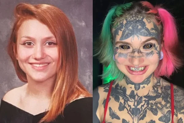 antes e depois da influenciadora Orylan