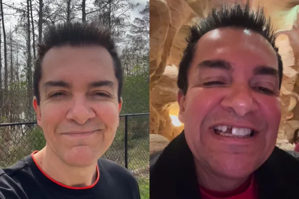 Regis Danese viraliza após perder dente durante viagem aos EUA. Vídeo