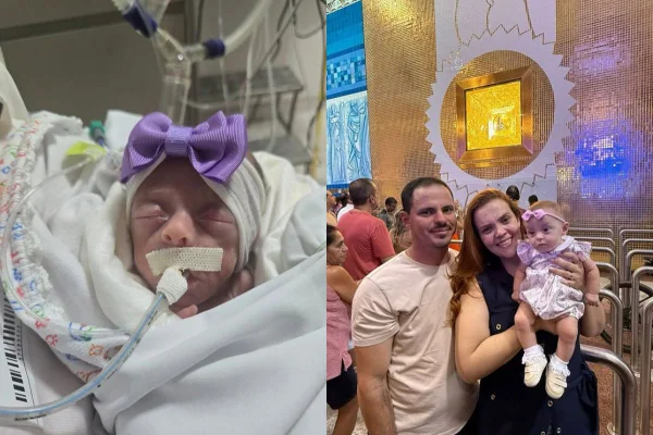 Bebê de 624g vence os 1% de chance de vida e é batizada em Aparecida