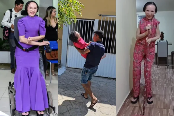 Montagem de fotos mostra Martinha Brito em três ocasiões. Ela tem FOP, fibrodisplasia ossificante progressiva, a doença da estátua-viva - Metrópoles