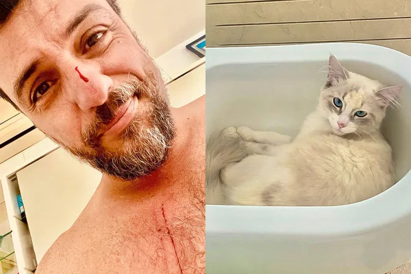 Rodrigo Lombardi, à esquerda, aparece ensanguentado; à direita, a autora dos ferimentos: a gata Alice - Metrópoles