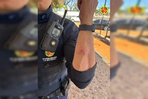 Foto colorida de antebraço mordido de PM
