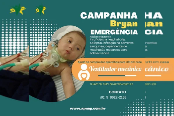 Associação pede doações para auxiliar bebê com hidrocefalia