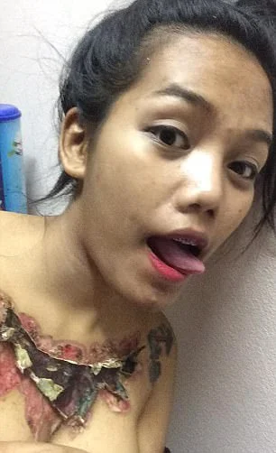 Garota relata momentos de dor ao remover tatuagem com método polêmico - imagem 9 Garota relata momentos de dor ao remover tatuagem com método polêmico - imagem 9