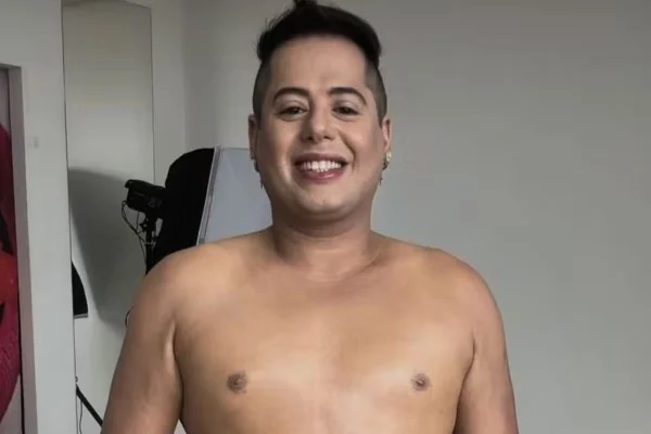 Irreconhecível! Veja o antes e depois de Hugo, da dupla com Tiago