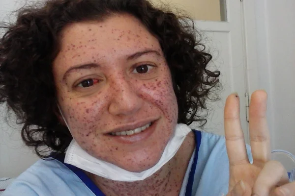Mulher com doença rara