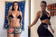 Giovanna Lima exibe antes e depois
