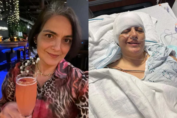 Montagem de fotos mostra Gilmara Bertini durante o tratamento do seu câncer no cérebro da segunda vez que ele se manifestou