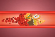 O LDL, conhecido como colesterol "ruim", quando está em níveis altos, pode formar uma placa nas paredes das artérias, dificultando ou impedindo a passagem do sangue O LDL, conhecido como colesterol "ruim", quando está em níveis altos, pode formar uma placa nas paredes das artérias, dificultando ou impedindo a passagem do sangue