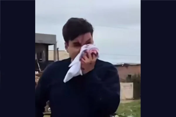 Vereador ficou com o rosto ensanguentado com a agressão