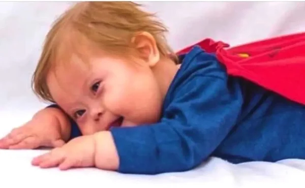Morre Super Chico, menino com Down que superou a Covid por duas vezes