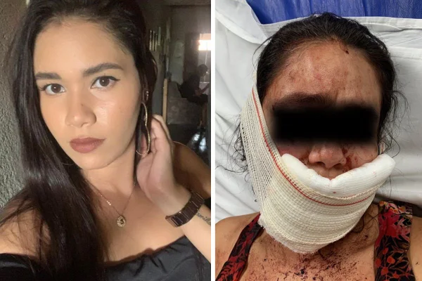 Foto colorida Maria Nadine antes e depois de sofrer violência doméstica