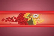 O LDL, conhecido como colesterol "ruim", quando está em níveis altos, pode formar uma placa nas paredes das artérias, dificultando ou impedindo a passagem do sangue