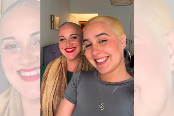 Mãe e filha carecas