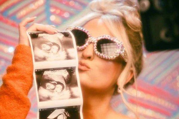 Meghan Trainor posa de oculos escuros com ecografias - metrópoles