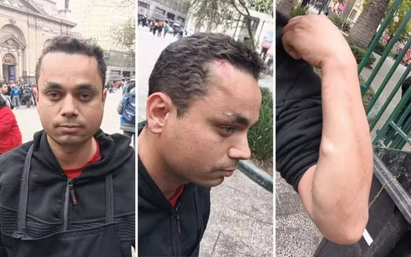 imagem colorida goiano agredido no chile - Metrópoles