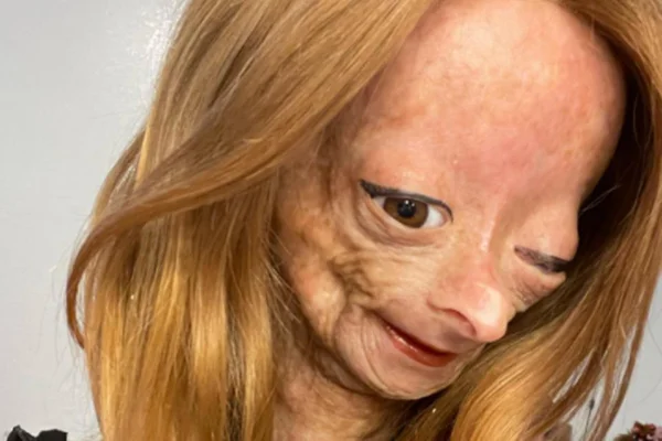 Adalia Rose Williams