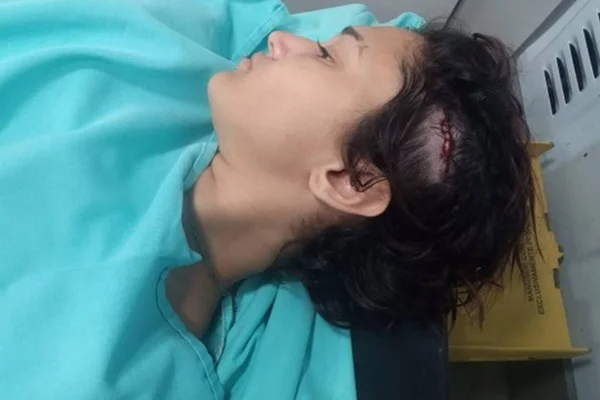Jovem é agredida com pedaço de madeira após criticar Bolsonaro no RJ