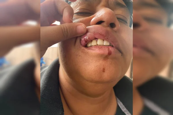 Homem dá soco em boca de lésbica em frente a boate: “Tu não é macho?”
