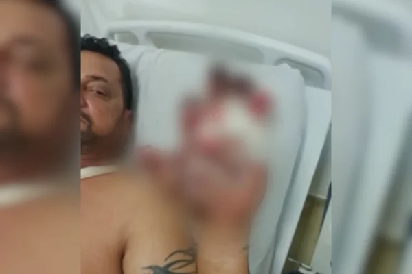 Imagem colorida de uma mão com os dedos explodidos - Metrópoles