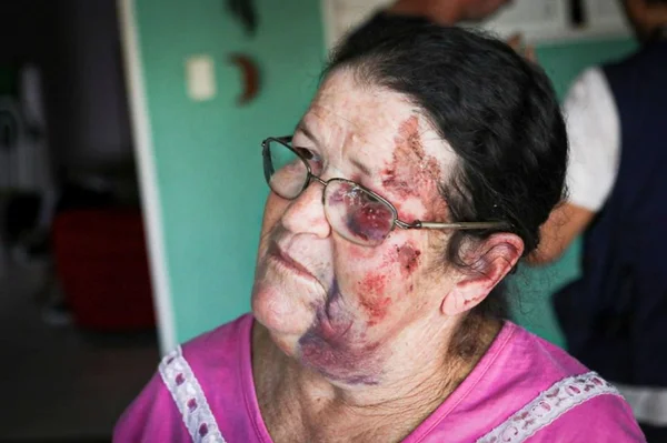 Vaquinha arrecada mais de R$ 25 mil para mulher arrastada por carro